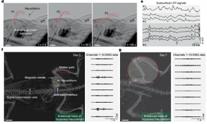 我国科学家开发出“神经蠕虫”：脑机接口“动态电极”大突破，能在脑子里“爬”